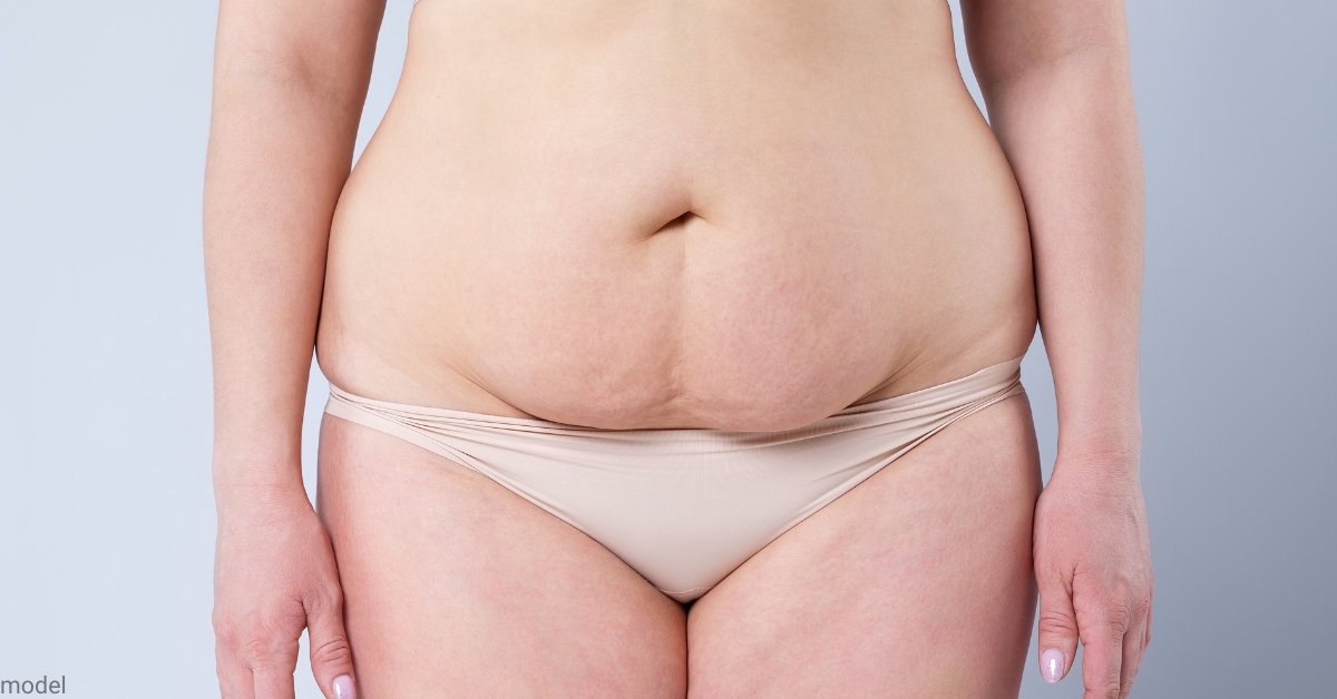 Pros and Cons of Tummy Tuck Surgery