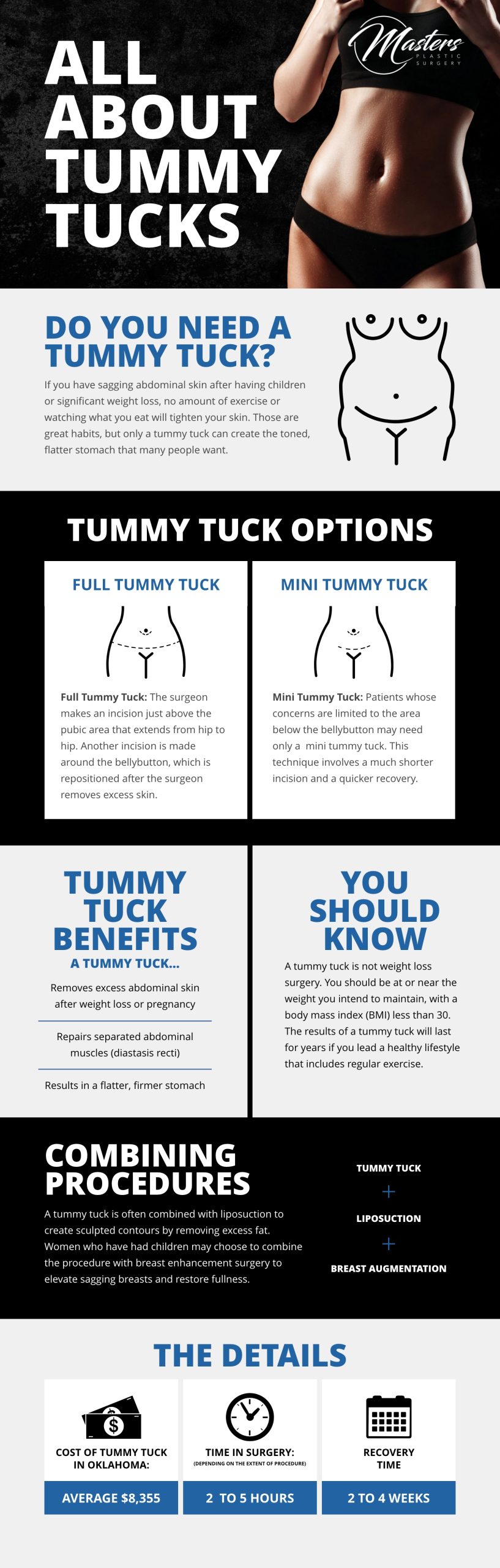 All about tummy tucks infographic.