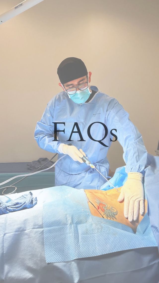 FAQs with Dr. OKC

Why does Dr. Master offer oral sedation for a in office revision lipo procedure ? 

FOLLOW ALONG…

Call us today to Book an appointment

(405) 849-6354

or click the link in our bio.

#safeliposuction #safelipo #bodylift #nicholshills #plasticsurgeon #plastics #plasticsurgeonsofinstagram #mastersplaticsurgery #drOKC